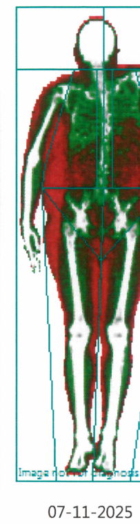 DEXA scan, Nov 2025