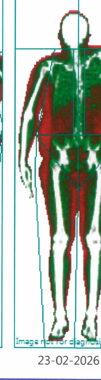 DEXA scan, Feb 2026