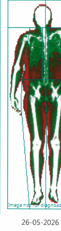 DEXA scan, May 2026