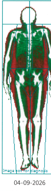 DEXA scan, Sep 2026