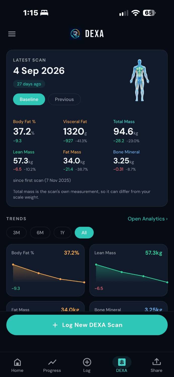 Recomp Health app — DEXA
